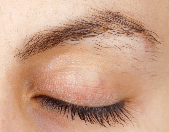 Neutralización y Corrección  de Cejas