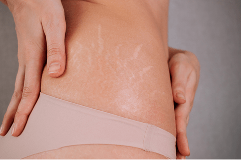 Lisca-Beauty-eeuu-School-micropigmentacion-9