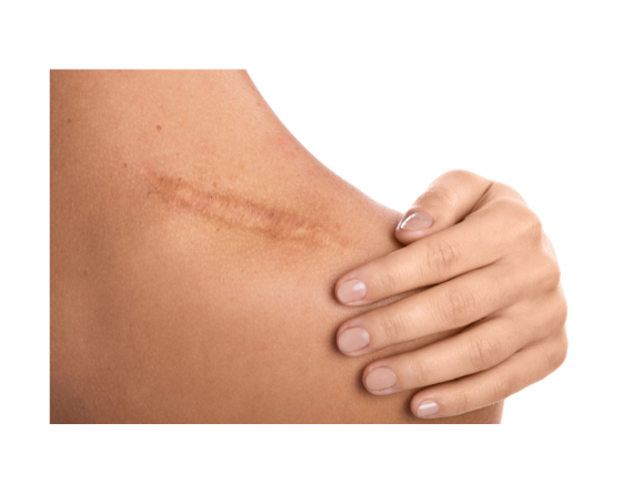 Lisca-Beauty-eeuu-School